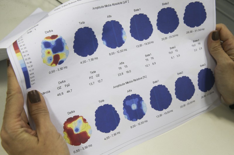 Março Roxo quer conscientizar população sobre a epilepsia